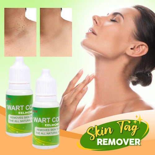 Skin Tag Remover