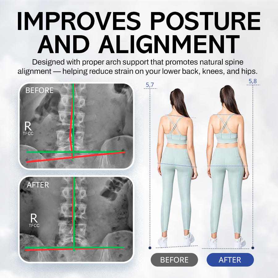 NEGUSY Shock-Absorbing Arch Support Orthotic Insoles