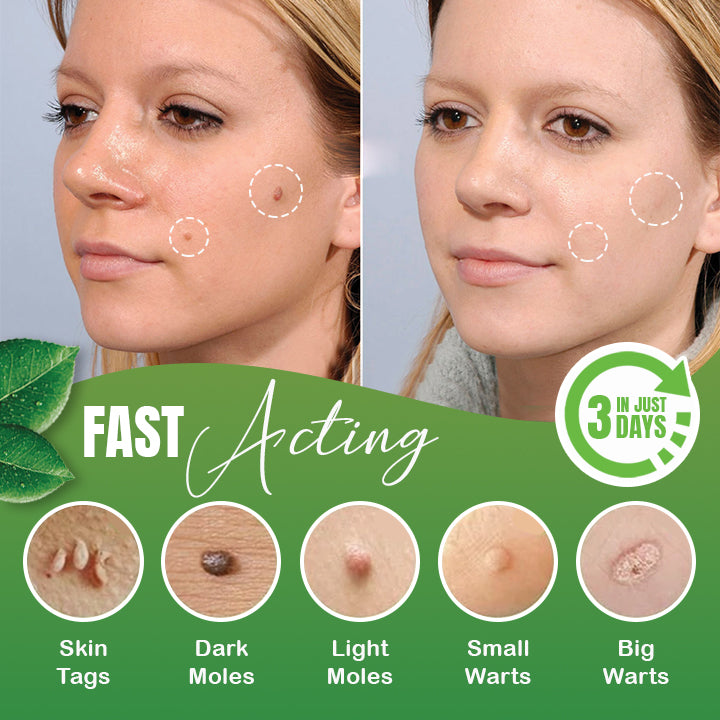 Skin Tag Herbal Removal Patch