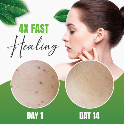 Skin Tag Herbal Removal Patch